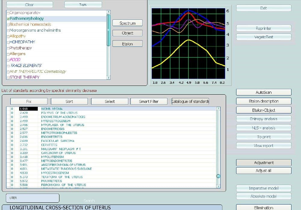 JYTOP 9DNLS Quantum Bioresonance Scanner 9D NLS Body Health Analyzer