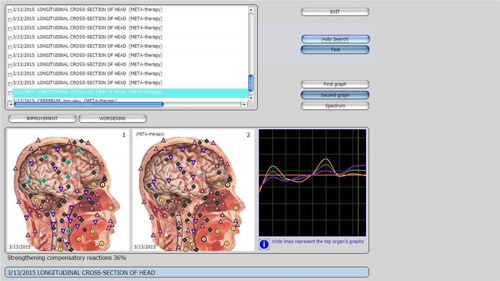 JYTOP 9DNLS Quantum Bioresonance Scanner 9D NLS Body Health Analyzer