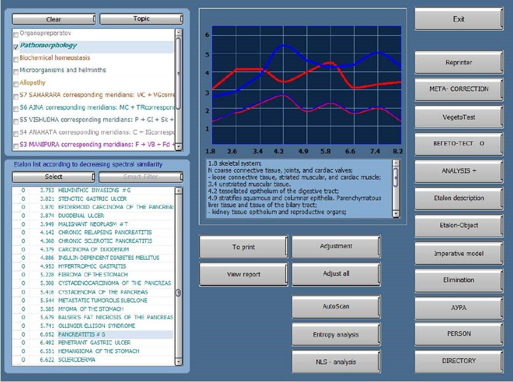 JYTOP 9DNLS Quantum Bioresonance Scanner 9D NLS Body Health Analyzer