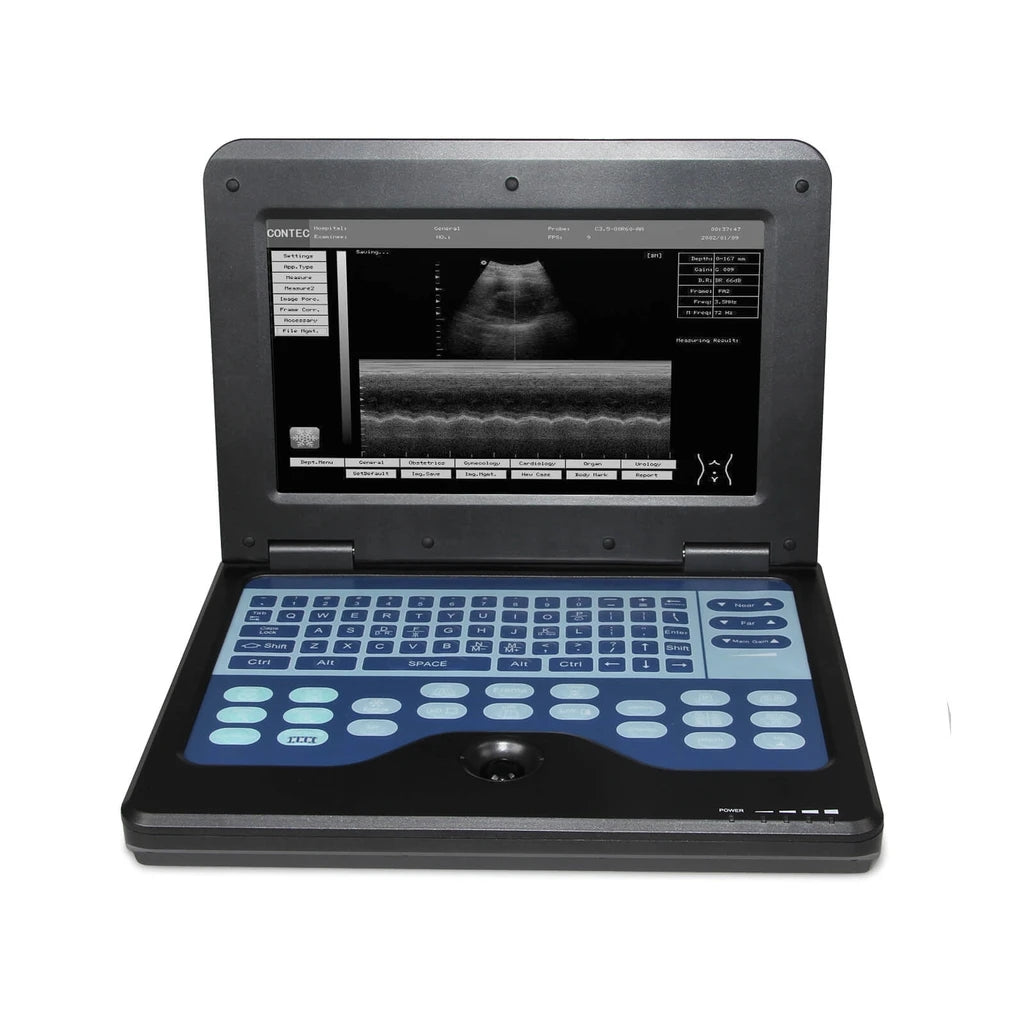 JYTOP Portable Laptop Machine Digital Ultrasound Scanner,6.5 MHz endo-vaginal probe CMS600P2