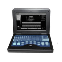 JYTOP Portable Laptop Machine Digital Ultrasound Scanner,2Probes Convex +endo-vaginal CMS600P2