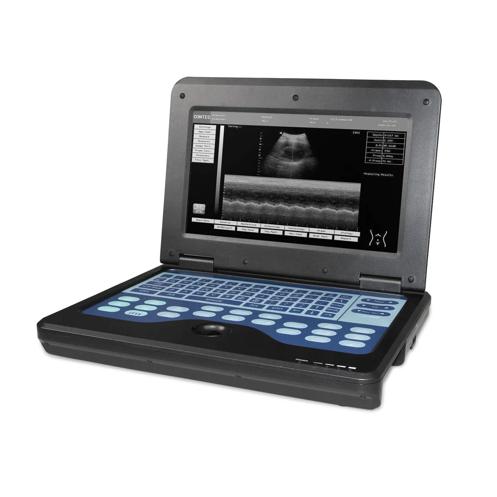 JYTOP Portable Laptop Machine Digital Ultrasound Scanner,3.5 Convex Probe CMS600P2