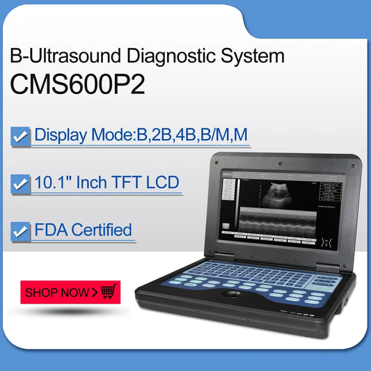 JYTOP Portable Laptop Machine Digital Ultrasound Scanner,3.5 Convex Probe CMS600P2