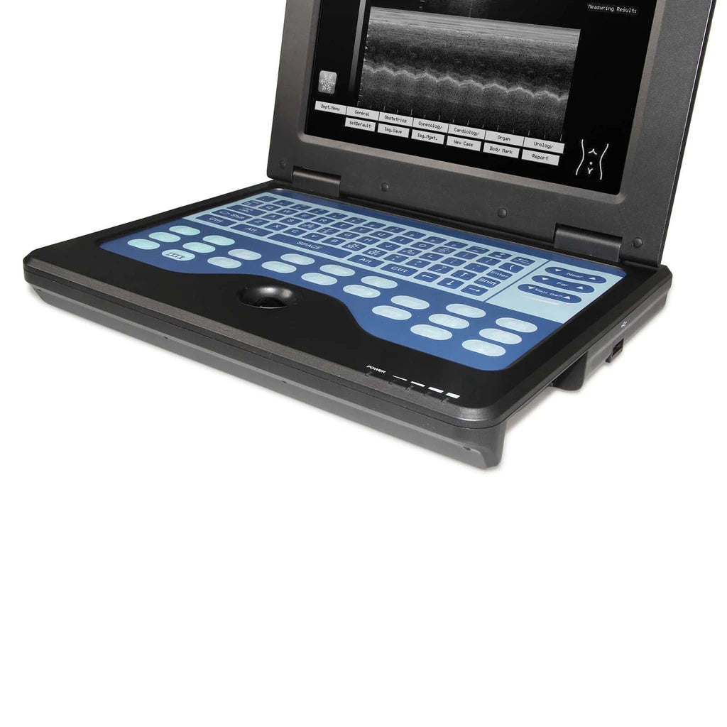 JYTOP Portable Laptop Machine Digital Ultrasound Scanner,7.5M Linear+3.5M Convex Probe