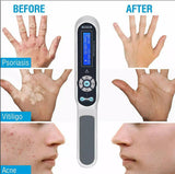 JYTOP Kernel KN-4003 BL CE ISO approved home use narrow band UVB 311nm lamp Phototherapy for vitiligo psoriasis eczema with comb 2020
