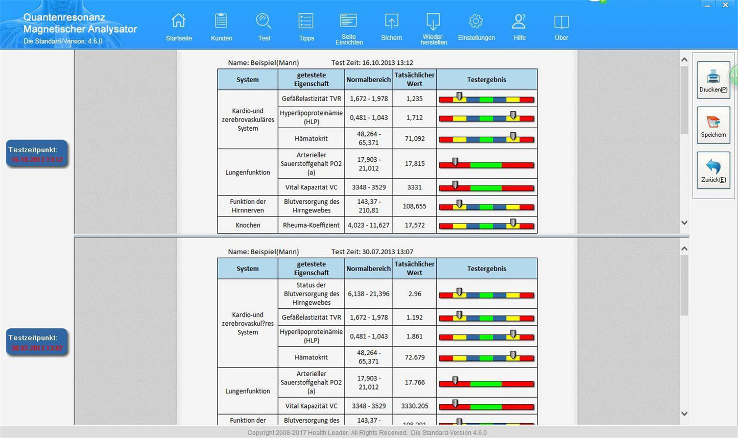 JYTOP Quantum Body Analyzer 45 Reports Both English & Spanish Version Software Win 7 / WIN 8 / Win 10