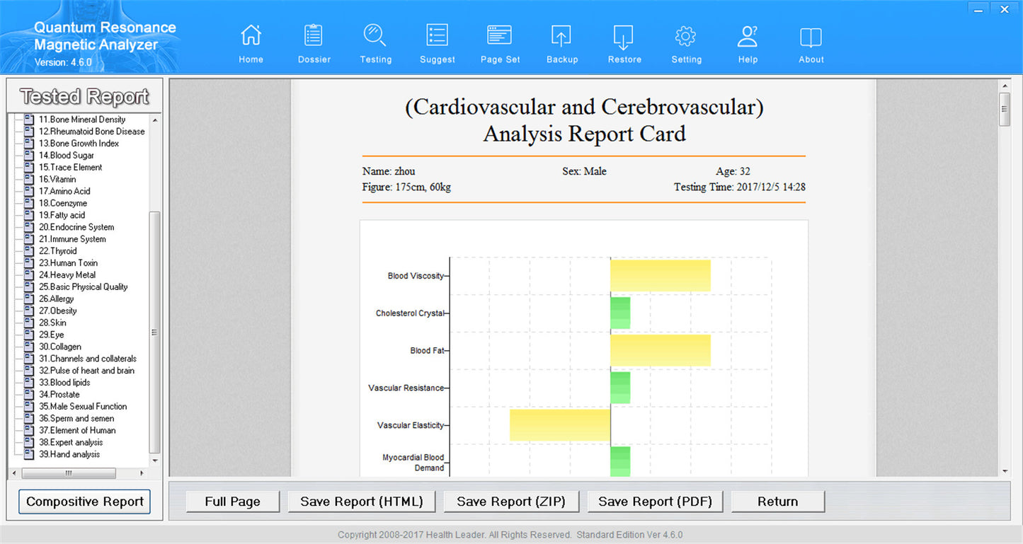 JYTOP Quantum Body Analyzer 45 Reports Both English & Spanish Version Software Win 7 / WIN 8 / Win 10