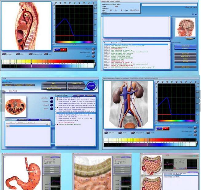 JYtop Bioresonance Therapy Device 3D NLS Health Analyzer Equipment 3D NLS Analyzer with Original Software