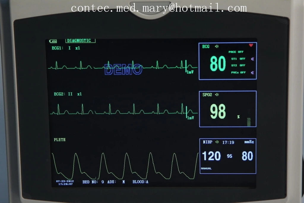 JYTOP CMS6000C Portable Capnograph Patient Monitor CO2 Vital Signs Monitor 6 parameters+ETCO2