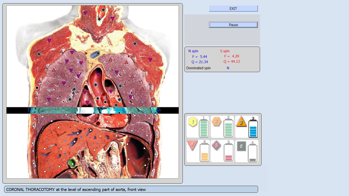 JYtop Latest 9D NLS CELL Diagnostics Bioresonance Sub Health Analyzer Diacom Quantum Black